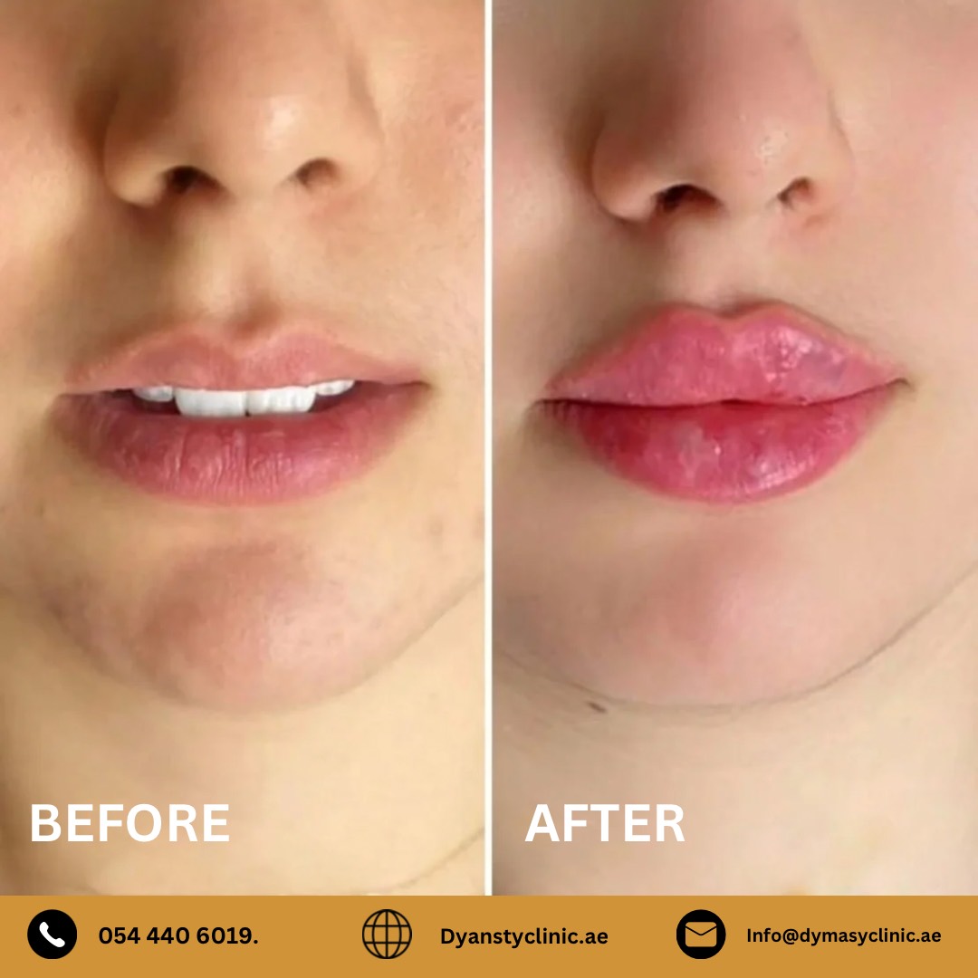 dermatology-before-after