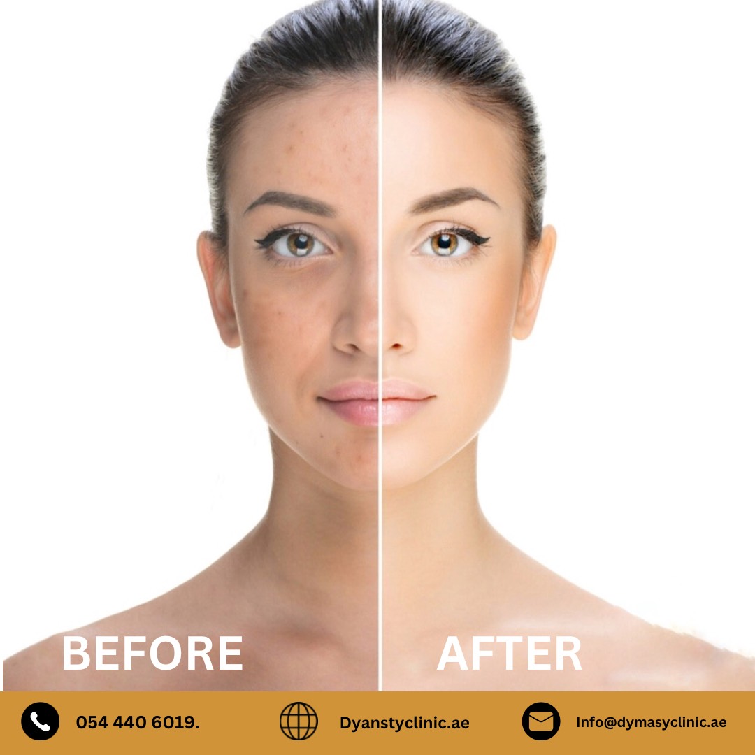 dermatology-before-after