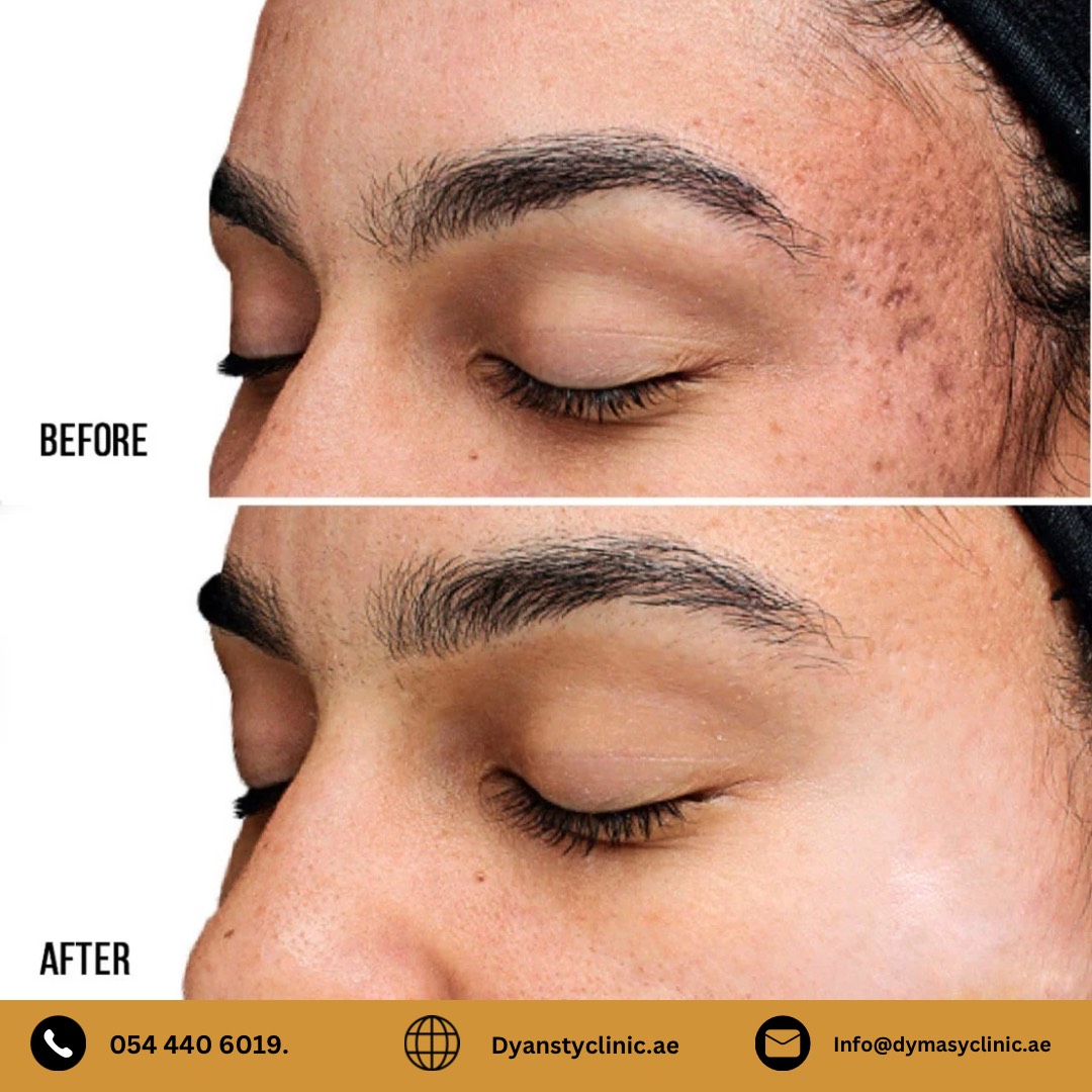 dermatology-before-after