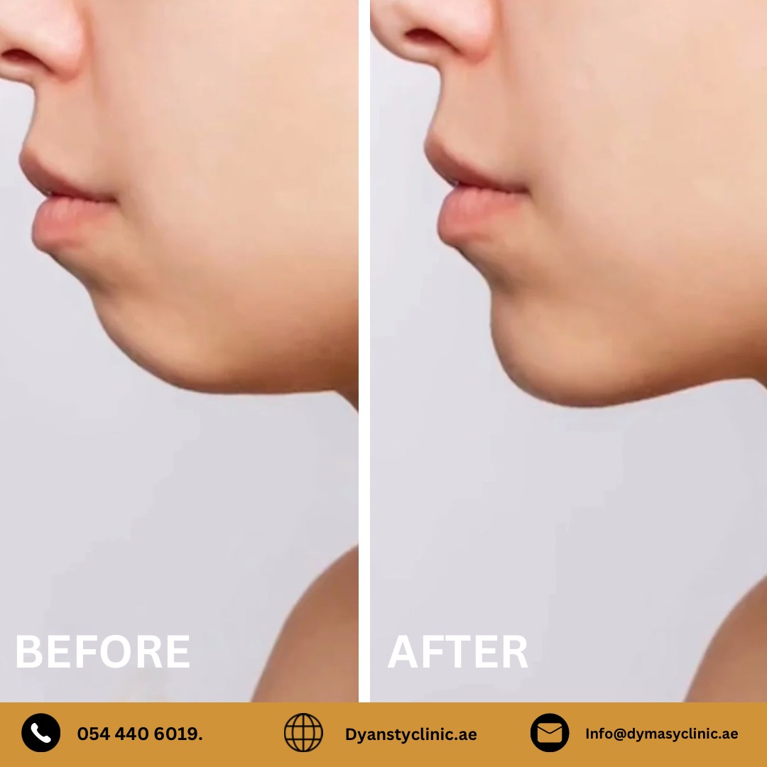dermatology-before-after